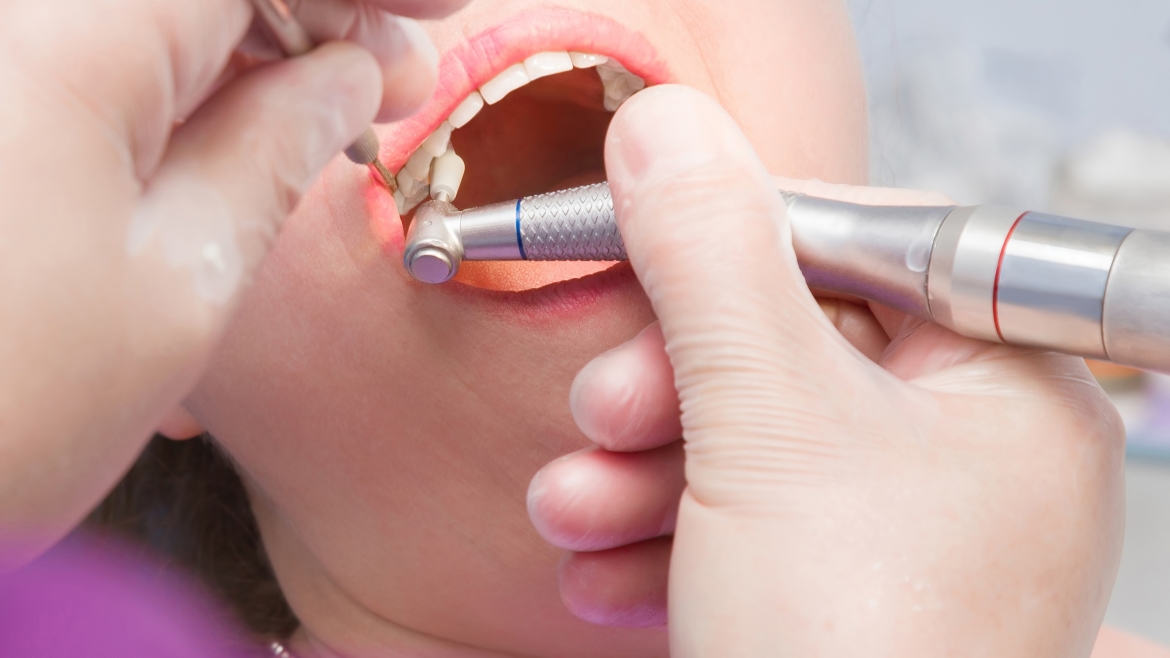 Higiene dental profesional: conoce sus beneficios