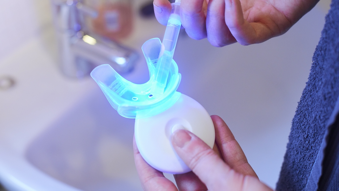 Blanqueamiento dental vs. blanqueamiento casero: ¿Cuál es la mejor opción para ti?