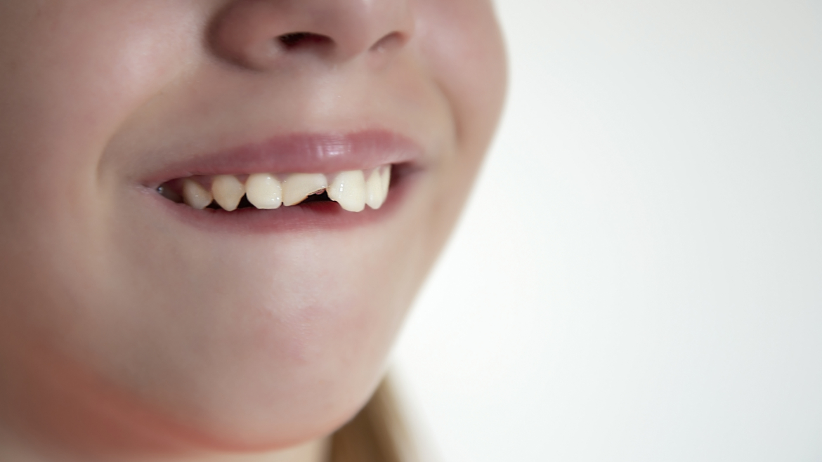 Lesiones dentales en niños: primeros auxilios y cuidados