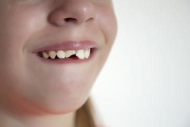 Lesiones dentales en niños: primeros auxilios y cuidados