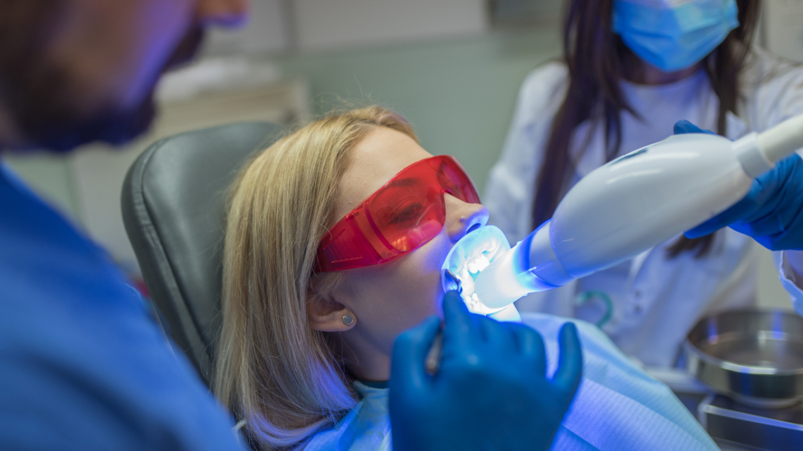 Errores que arruinan tu blanqueamiento dental: Cómo evitar las manchas