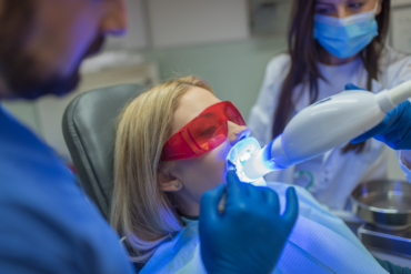 Errores que arruinan tu blanqueamiento dental: Cómo evitar las manchas