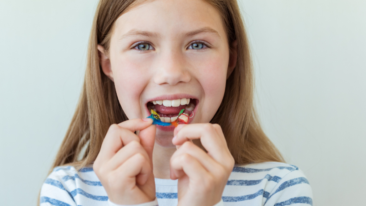 Ortodoncia preventiva en niños: La clave para un desarrollo facial sano