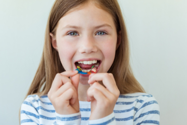 Ortodoncia preventiva en niños: La clave para un desarrollo facial sano
