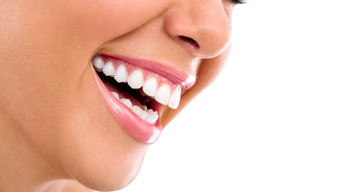 Escultura dental: El arte de modelar tu sonrisa sin tallar tus dientes