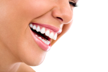 Escultura dental: El arte de modelar tu sonrisa sin tallar tus dientes