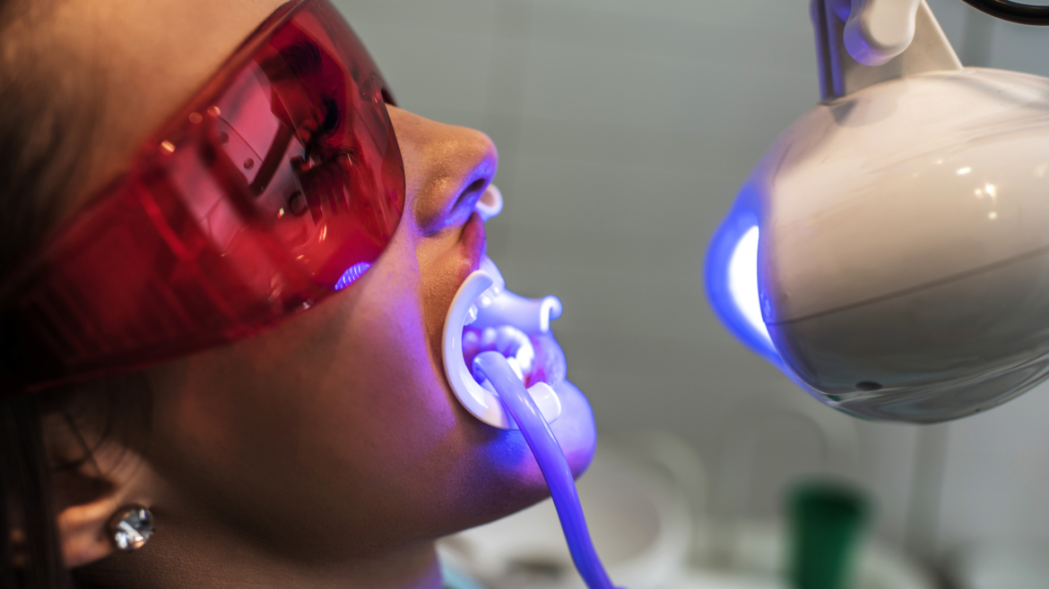 ¿Por qué los dientes pueden volver a oscurecerse después de un blanqueamiento?