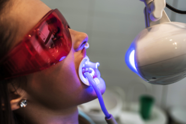 ¿Por qué los dientes pueden volver a oscurecerse después de un blanqueamiento?