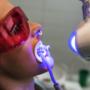 ¿Por qué los dientes pueden volver a oscurecerse después de un blanqueamiento?