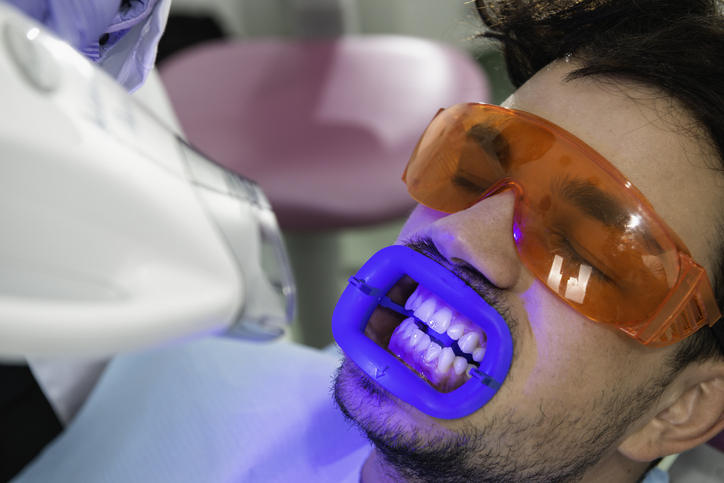 Manchas en los dientes: ¿el blanqueamiento dental puede eliminarlas?